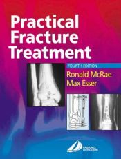 book cover of Practical fracture treatment by Ronald McRae
