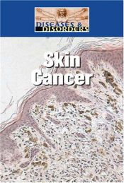 book cover of Skin Cancer by No Author Yet