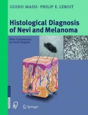 book cover of Histological Diagnosis of Nevi and Melanoma by Guido Massi