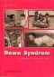 Down Syndrom : ein Ratgeber für Eltern und Erzieher